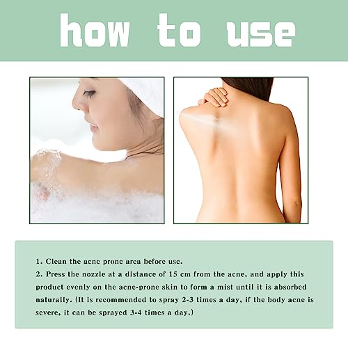 ERIKO 2% Salicylic Acid Back Acne Spray, Tea Tree Oil + Body Acne Spray with 2% Salicylic Acid, Teen acne treatment