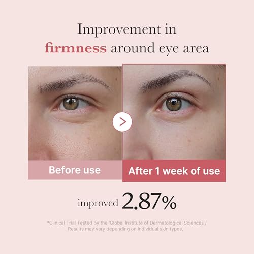 Medicube Salmon DNA PDRN Pink Peptide Eye Serum - Niacinamide & 99% Pure Retinol Eye Cream for Fine Lines & Dark Circles - Korean Skin Care 1.01fl.oz