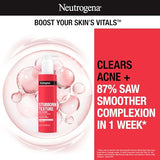Neutrogena Stubborn Texture Daily Acne Facial Cleanser, Salicylic Acid + Glycolic & Polyhydroxy Acids, Fragrance-Free, 6.3 fl. oz