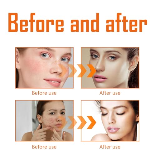 Xiquzal Turmeric Exfoliating Toner - Hydrating Toner for Dark Spots & Acne - 04