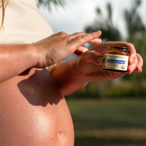 Motherlove Organic C-Section Scar Balm - Herbal Massage Cream (2 oz)
