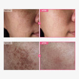 TOSOWOONG Arbutin 7% + Tranexamic Acid 4% Cream – Dark Spot & Pigmentation Treatment