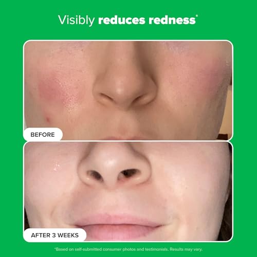 Paula's Choice 10% Azelaic Acid Booster: Brighten & Smooth Skin