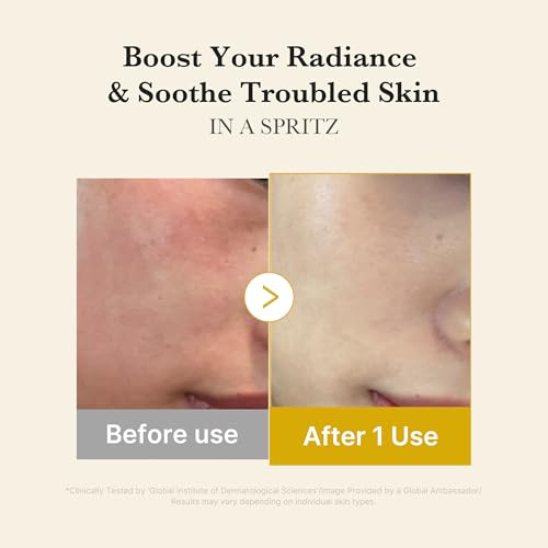 Medicube Vitamin Coric Acid Serum Mist - Hydrating Jelly Texture Spray for Dry Skin