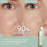 Caudalie Vinopure Clear Skin Purifying Toner (200ml) - Balance & Refine