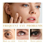 Collagen Eye Cream - Hydrates, Nourishes & Tightens Under Eye, Reduces Lines, 30ml