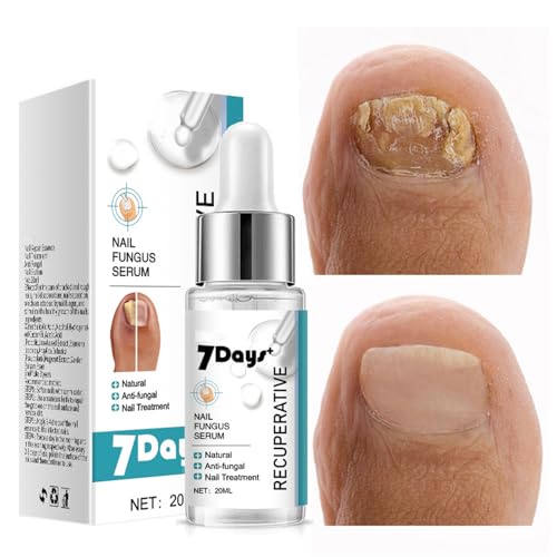 Nail Fungus Treatment Essence - Fungal Nail Repair for Toes & Ingrown Nails (20ml)