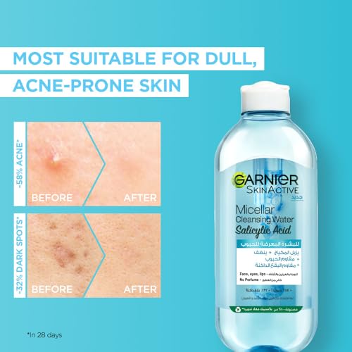 Garnier SkinActive Micellar Cleansing Water - Salicylic Acid for Acne
