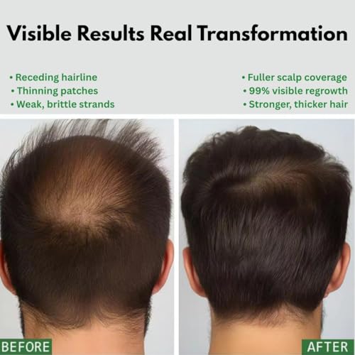 100% Pure Batana Oil for Hair Growth – Thickens & Strengthens Hair – Deeply Moisturizing Hair Oil – 4 FL OZ – Unrefined & Cold-Pressed