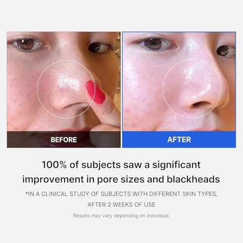 Medicube Zero Pore Pad - 155g (70 Pads) | Exfoliating Toner Pads for Pore Minimizing