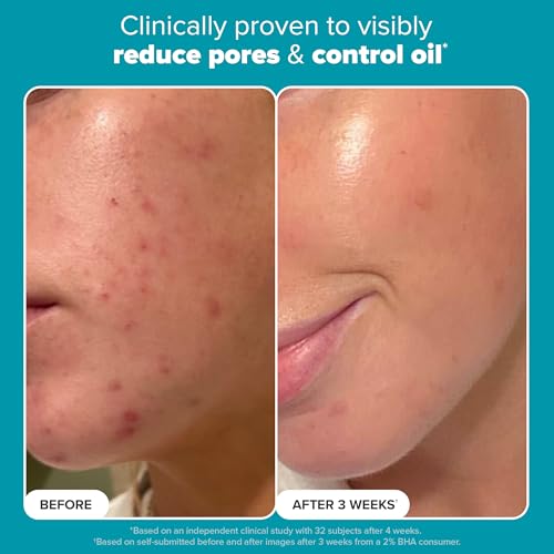 Paula's Choice Skin Perfecting 2% BHA Liquid Salicylic Acid Exfoliant Duo - Gentle Leave-On Exfoliant (Set of 2)