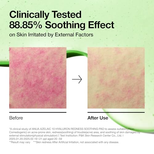 Anua Azelaic 10 Hyaluron Redness Soothing Pad – 90 Pads for Spot Care & Korean Toner Pads