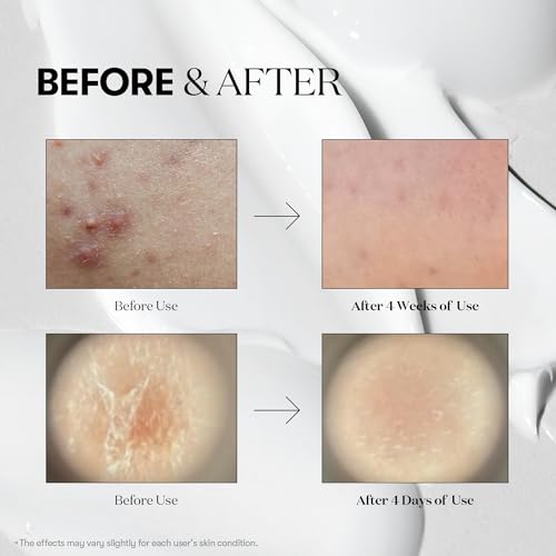 VT Cosmetics Reedle Shot Skincare Gift Set - 100, 300, 700 Serums for Her