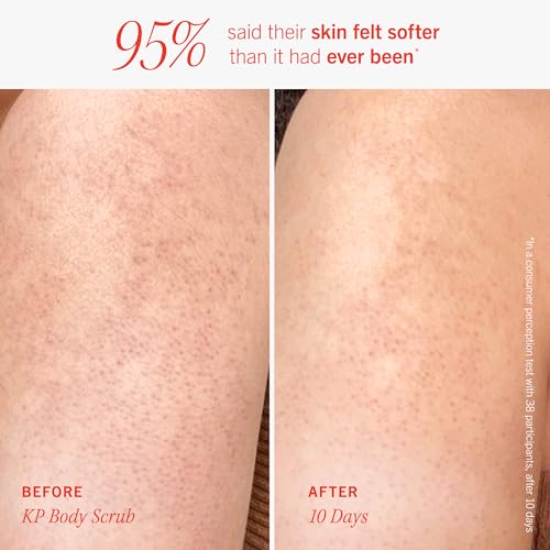 First Aid Beauty KP Bump Eraser Kit: AHA body scrub, smoothing lotion, Ingrown Hair Pads with BHA & AHA