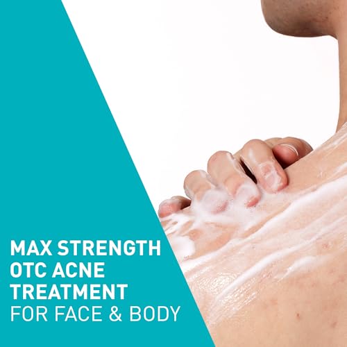 CeraVe Acne Foaming Cream Wash with Benzoyl Peroxide 10%, Hyaluronic Acid & Niacinamide - 5 oz