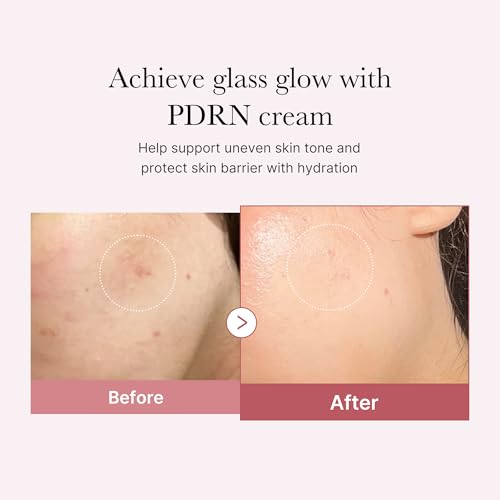 Medicube PDRN Pink Hyaluronic Moisturizing Cream - 50ml