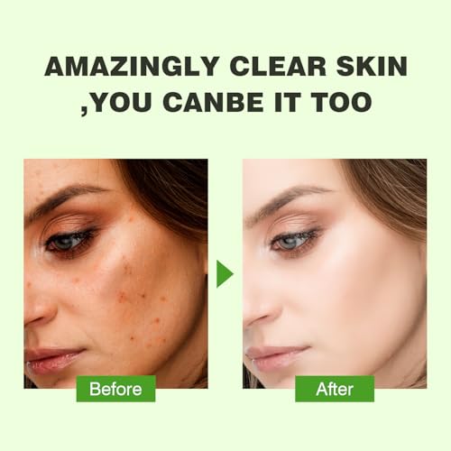 Snail Mucin Serum for Face - 30ml Hydrating Repairing Facial Essence