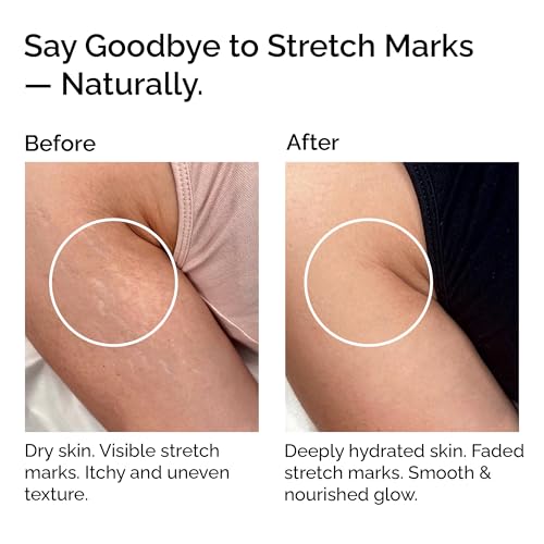 Unrefined Organic Shea Butter 50g - 100% Pure & Natural Vegan Butter for Face, Hair, Skin & Stretch Marks