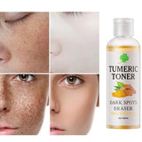 Makbeaty 100ml Facial Toner for Acne Prone Skin - Blemish Removing and Pore Minimizing