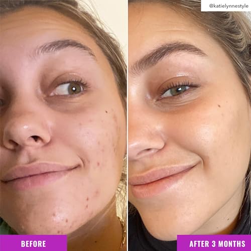 Good Molecules Niacinamide Brightening Toner - Pore Minimizer with Arbutin for Balanced Skin Tone