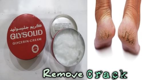 Glysolid Glycerin Cream (125ml) - Deep Moisturizing & Protective Skin Care