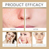 2PCS Day & Night Exfoliating Ampoule - Black and White Rice Duo for Glowing Skin, Brightening & Hydrating Peel