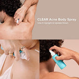 Paula's Choice Clear Body Spray: Salicylic Acid Acne Treatment