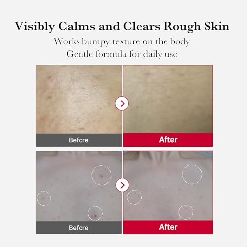 Medicube Red Body Peeling Shot - Strawberry Skin Exfoliating Spray with AHA, BHA & Succinic Acid - 3.88 oz