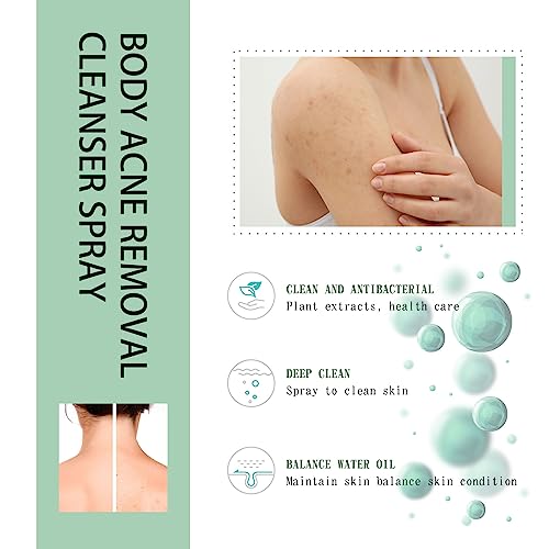 Body & Back Acne Spray with Salicylic Acid & Herbal Formula