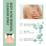 Body & Back Acne Spray with Salicylic Acid & Herbal Formula