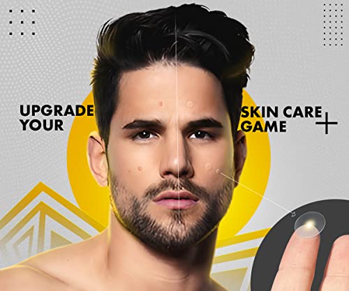 Urbangabru Acne Pimple Patch - 72 Invisible Facial Stickers with Hydrocolloid for Overnight Absorption