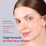 TOSOWOONG Niacinamide 10% + Tranexamic Acid 4% Serum - Korean Glass Skin Serum with Arbutin for Brightening & Radiant Complexion - 33ml