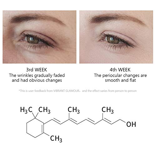 Vibrant Glamour Retinol Eye Serum: Reduce Dark Circles & Puffiness