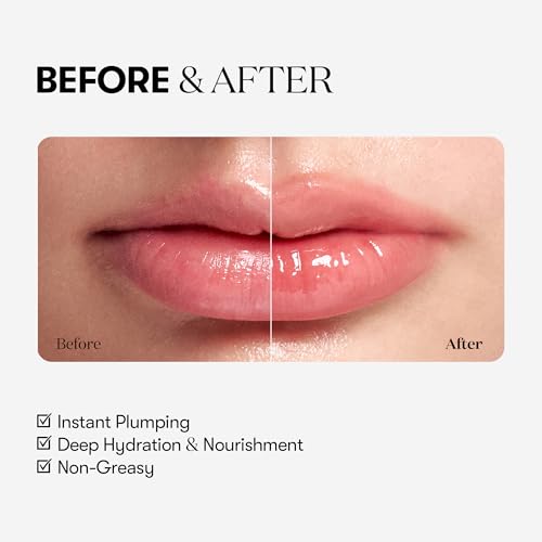VT Cosmetics Reedle Shot Lip Plumper - Hydrating & Volumizing Clear Lip Gloss (Beginner)