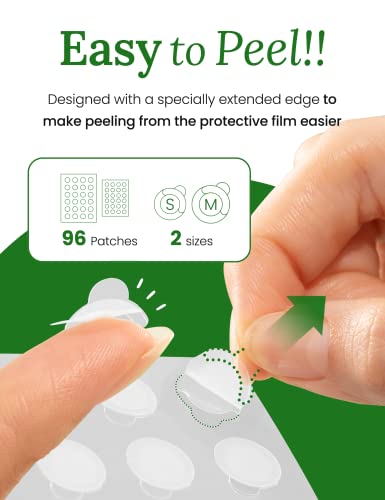 Troubless Invisible Pimple Patch Classic - 96 Ultra Thin Hydrocolloid Acne Patches for Daytime Use - Fast Healing & Oil Absorption