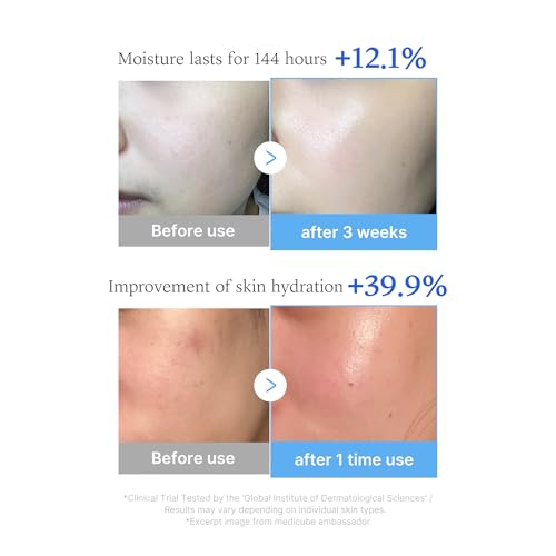 Korean Hyaluronic Acid Multipeptide Serum - Korean Beauty Essence for Moisturizing & Radiant Skin