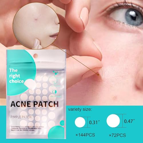 Sawanork Pimple Patches for Face - 216 Count Hydrocolloid Acne Stickers (2 Sizes)
