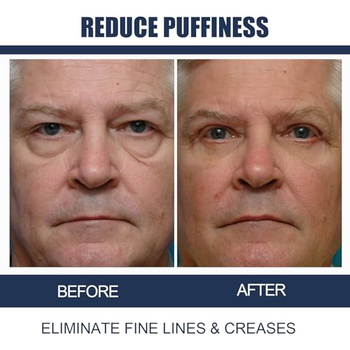 Men's Anti-Aging Eye Cream for Fine Lines and Under-Eye Bags, Hydration & Tightening, 15g