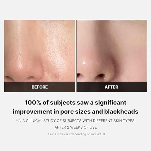 Medicube Zero Pore Pads 2.0 - Dual-Textured Exfoliating Toner Pads with AHA & BHA - 70 Pads