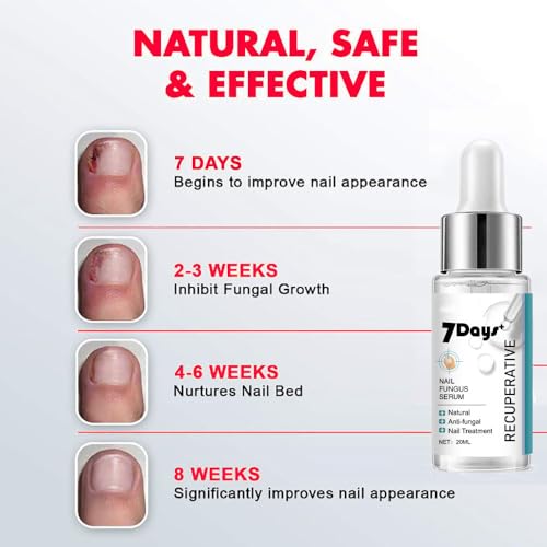 Nail Fungus Treatment Essence - Fungal Nail Repair for Toes & Ingrown Nails (20ml)