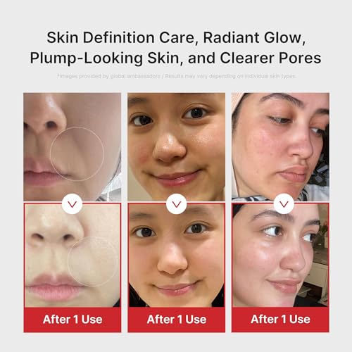 Medicube Age-R Booster Pro Pink LED Dermal Device with Microneedling | Glass Skin Technology | Korean Skin Care