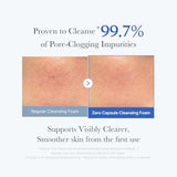 Medicube Zero Pore Clear Blue Capsule Facial Cleanser - Korean Skincare for Blackhead & Pore Care