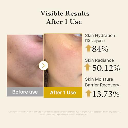 Medicube Vitamin Coric Acid Serum Mist - Hydrating Jelly Texture Spray for Dry Skin