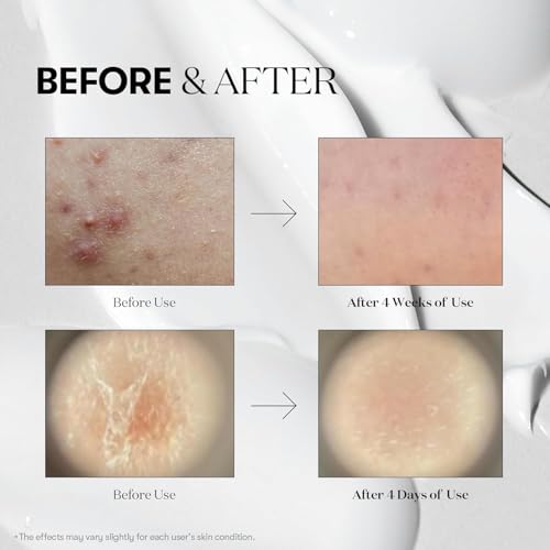 VT Cosmetics Reedle Shot 300 Micro-Needle Daily Treatment (10 Sticks)