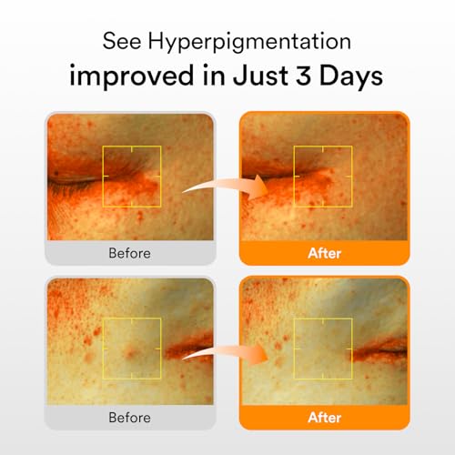 Abib Glutathiosome Dark Spot Serum - Korean Skincare with Niacinamide & Vitamin C (1.69 fl oz)