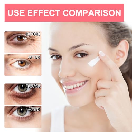 Retinol Eye Cream Stick for Firming & Brightening