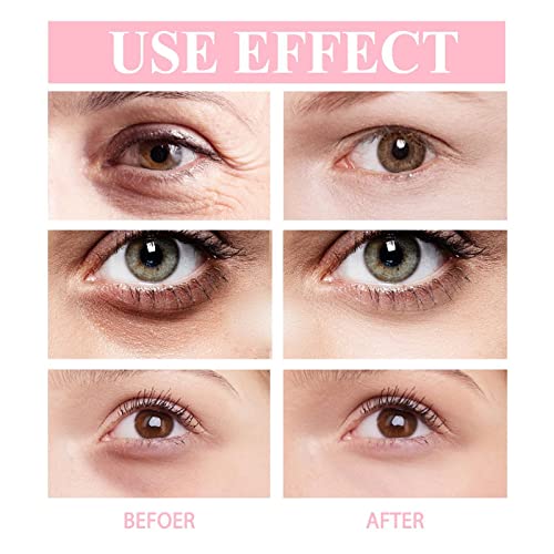 Retinol Eye Cream Stick for Anti-Wrinkle, Dark Circles & Firming