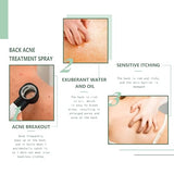 Back Acne Treatment Spray 120ml | Fade Scars, Deep Cleanse, Smooth Skin