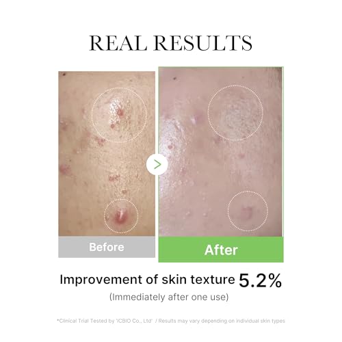 Medicube Exosome Cica Serum 30ml - Soothes & Repairs Skin with Exosome Technology
