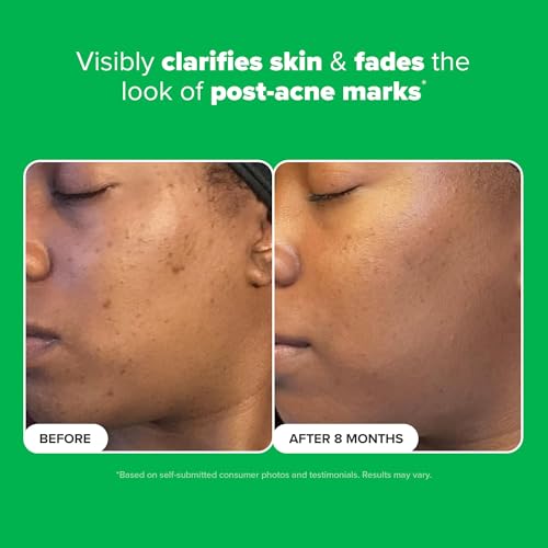 Paula's Choice 10% Azelaic Acid Booster: Brighten & Smooth Skin